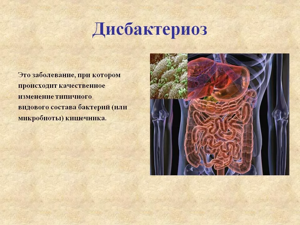 Избыточные бактерии в кишечнике. Дисбактериоз. Болезни органов пищеварения. Кишечный дисбактериоз. Дисбактериоз заболевание.