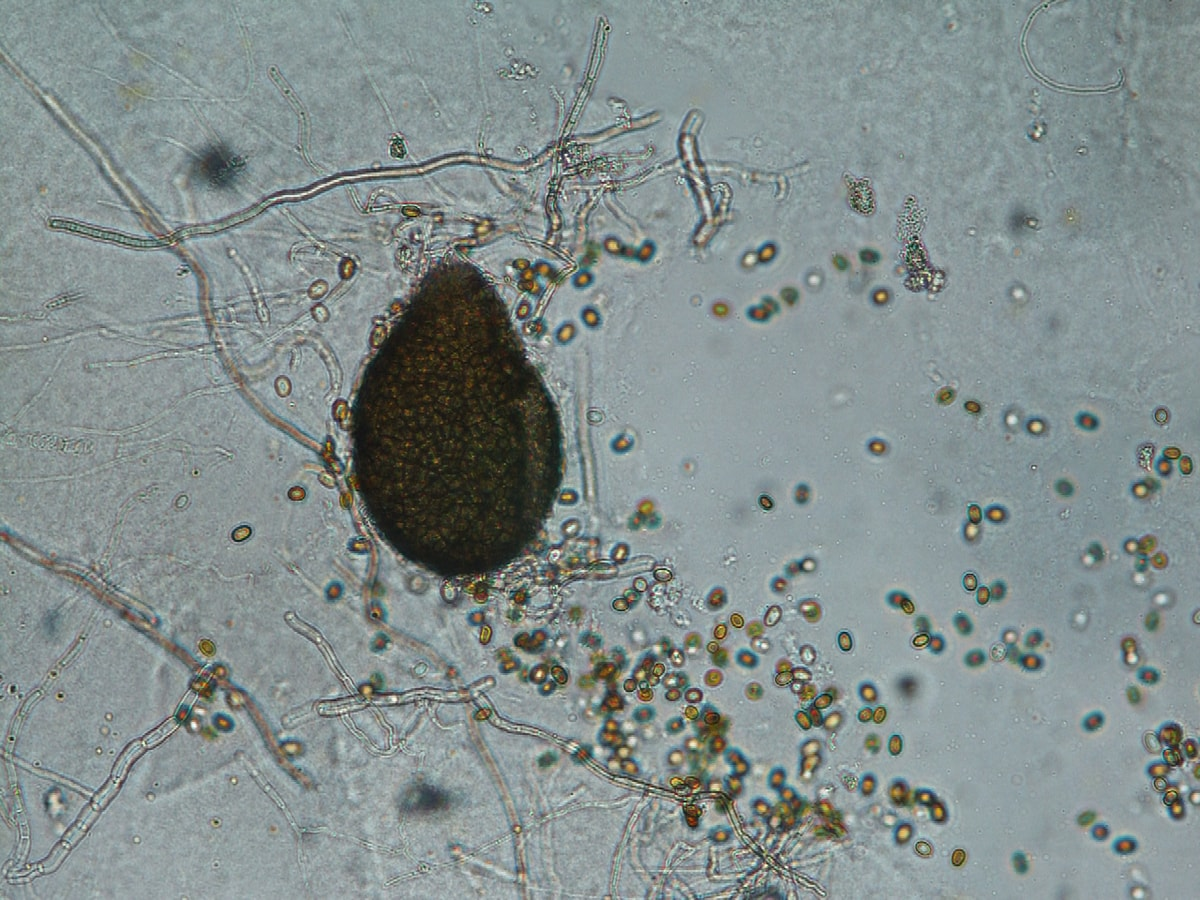  10. Ulocladium  Ulocladium относится к четвертой группе патогенности, поражает продукты и материалы.-2