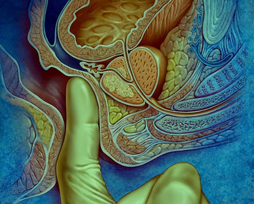 Инфекция способна спровоцировать простато везикулит