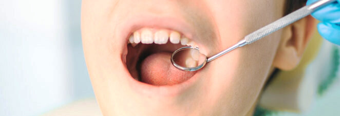 Визуальный осмотр полости рта