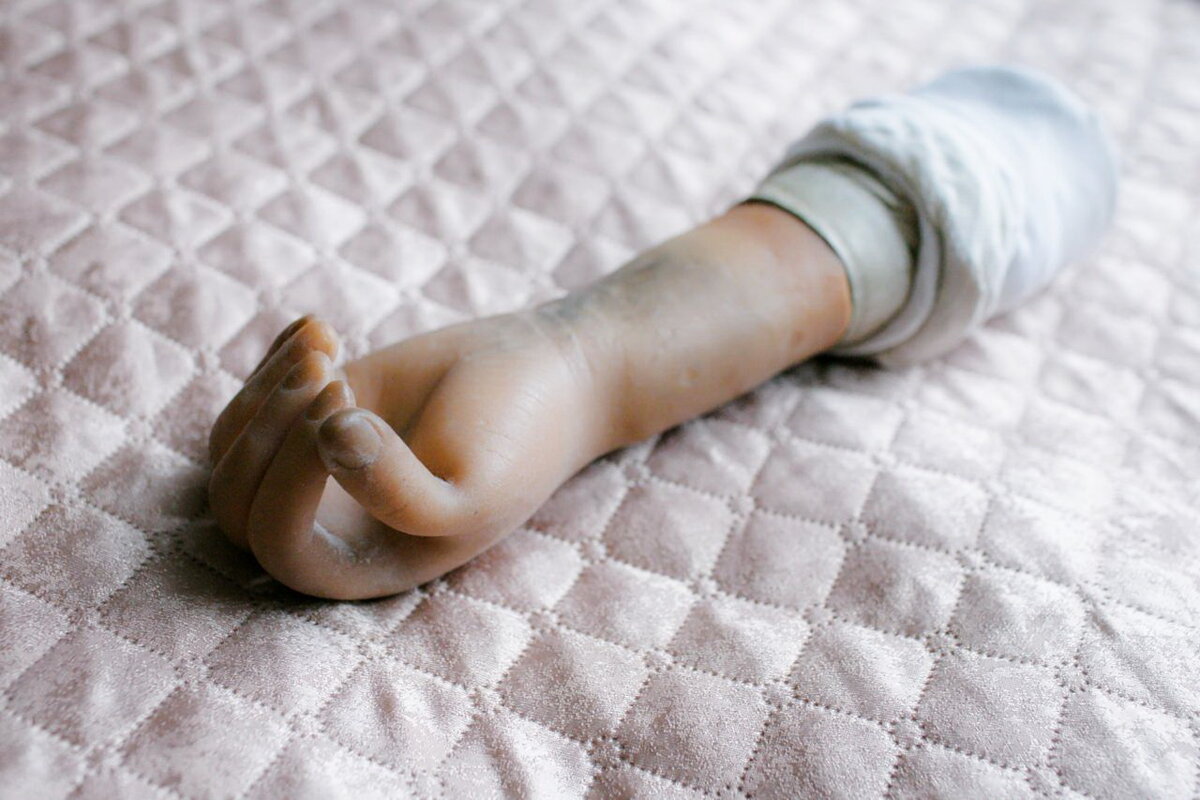 Многие просто не знают, что функциональные протезы доступны в России