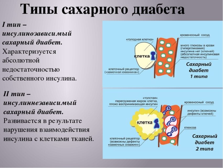 Диабет 1 тип планы на будущее