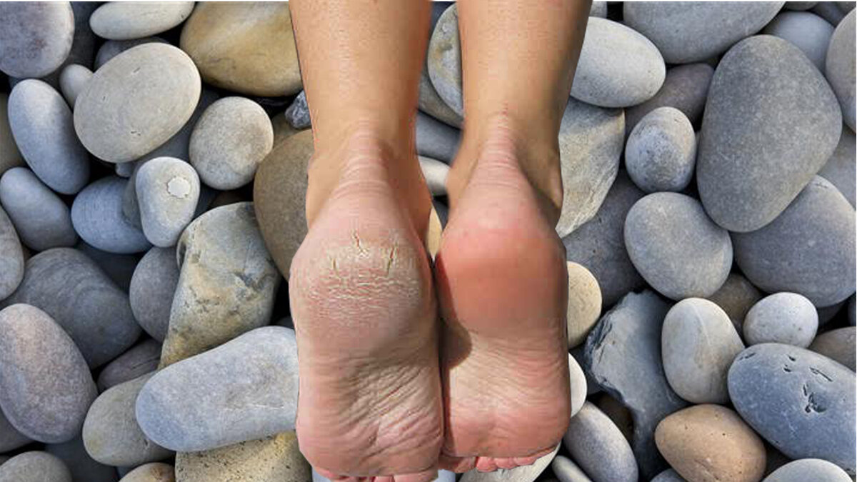 изображение использовано в качестве иллюстрации. Взято из открытых ИСТОЧНИКОВ