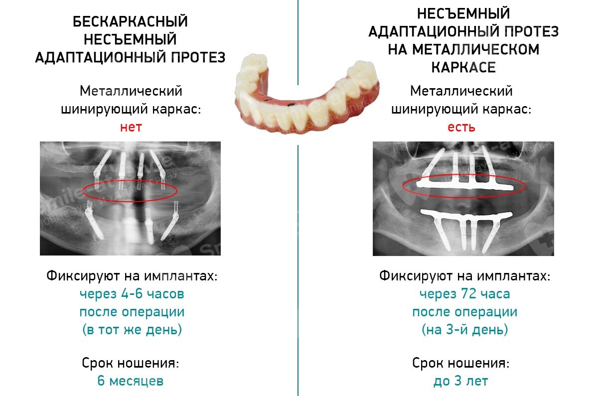 Срок имплантации