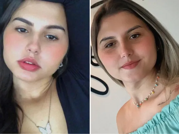 Identical twins undergo gender confirmation surgery together  