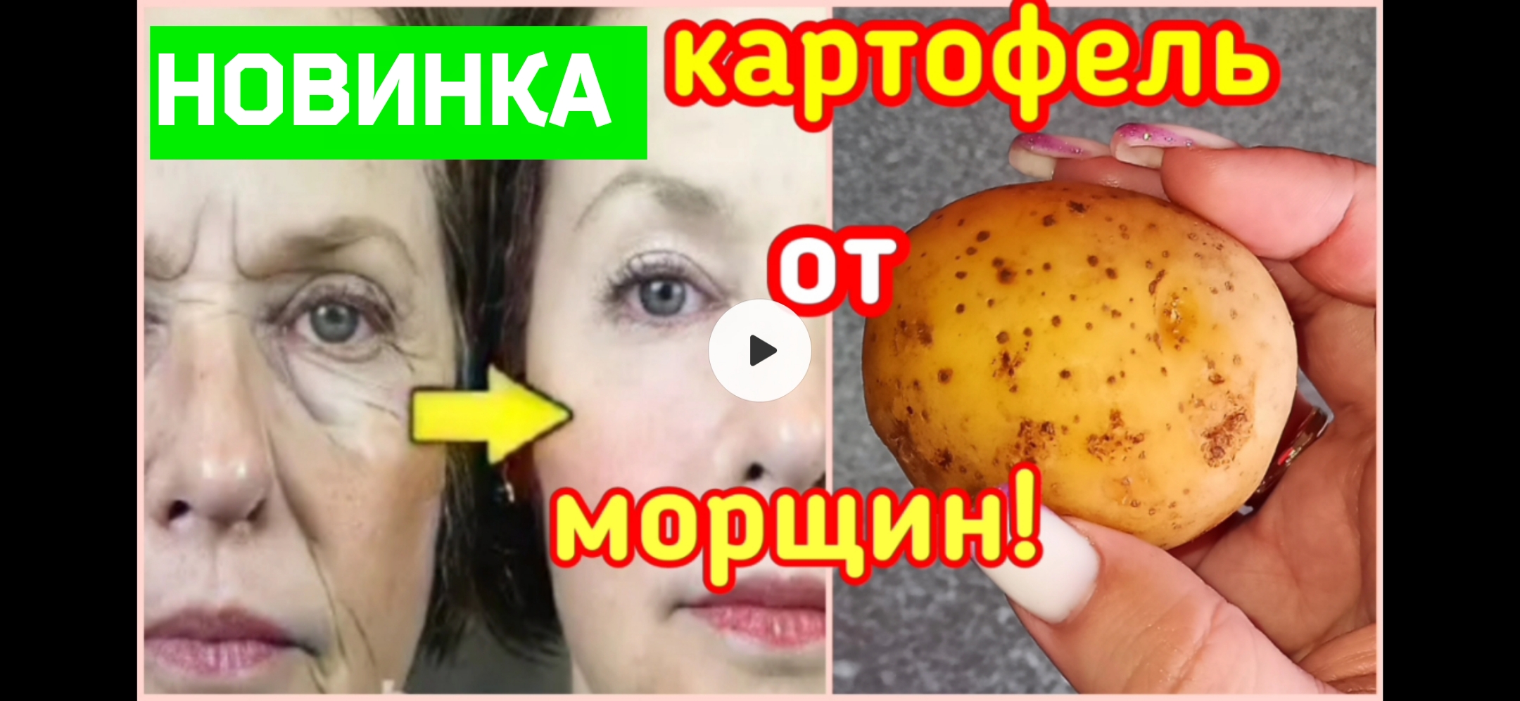 Удивительно. Картофель от Глубоких морщин. Гладкая, красивая кожа даже  после 50 лет. Натуральный рецепт. | Женский Журнал | Дзен