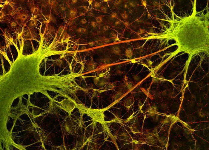 Электрический разряд разрушает нейронные связи, которые образовались недавно