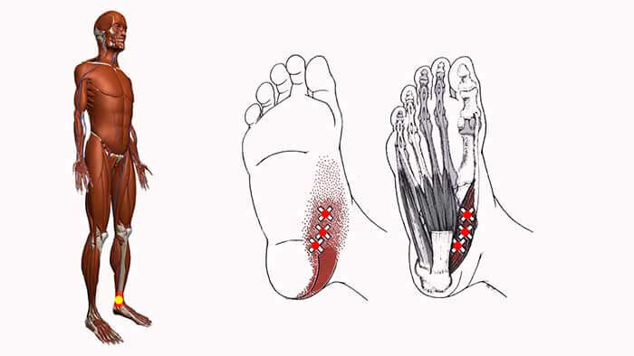 Триггерные точки ноги и стопы. Триггерные точки мышц стопы. Мышцы стопы миофасциальные триггерные точки. Сгибатели пальцев стопы триггерные точки.