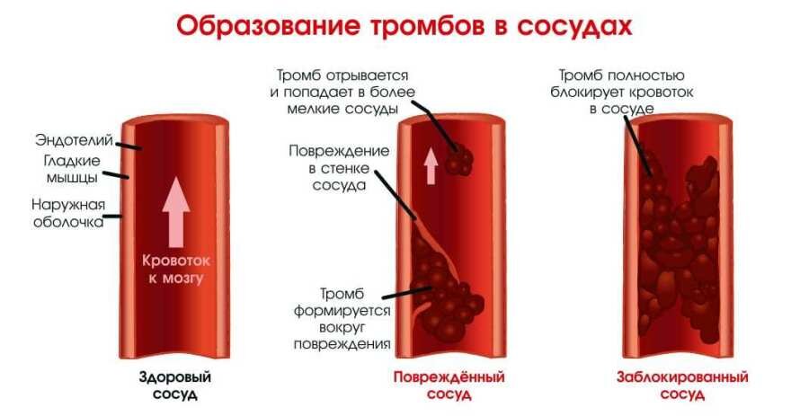 Источник - Яндекс картинки
