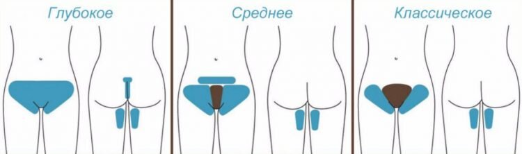 Виды обработки зоны бикини.