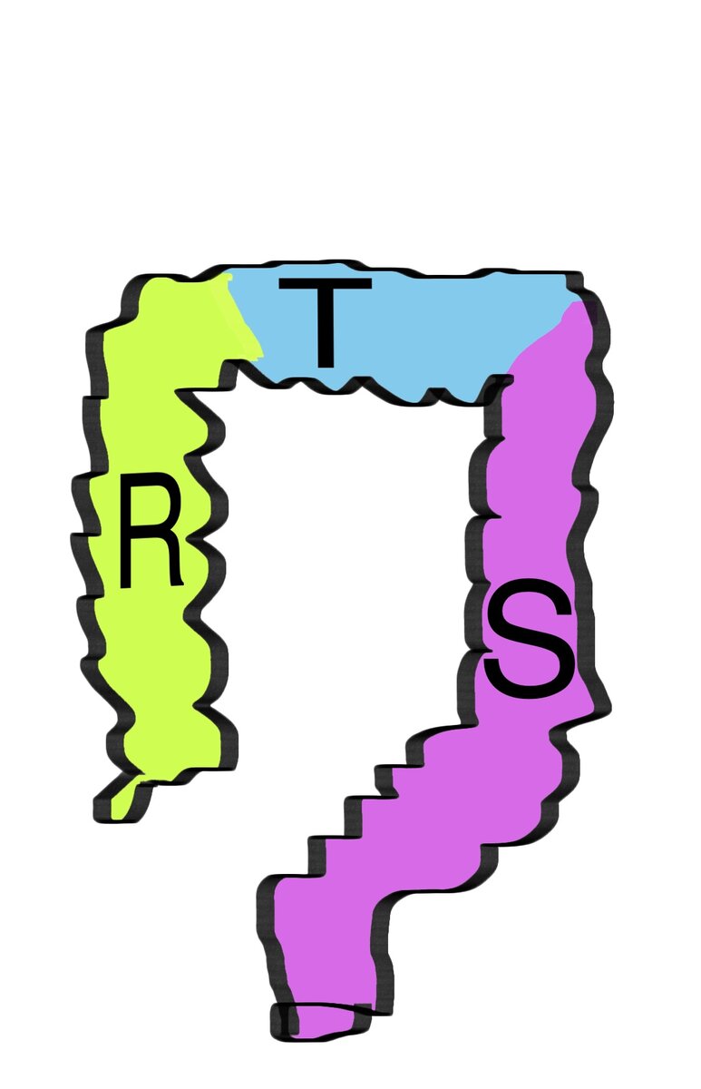 Схематичное изображение отделов толстого кишечника