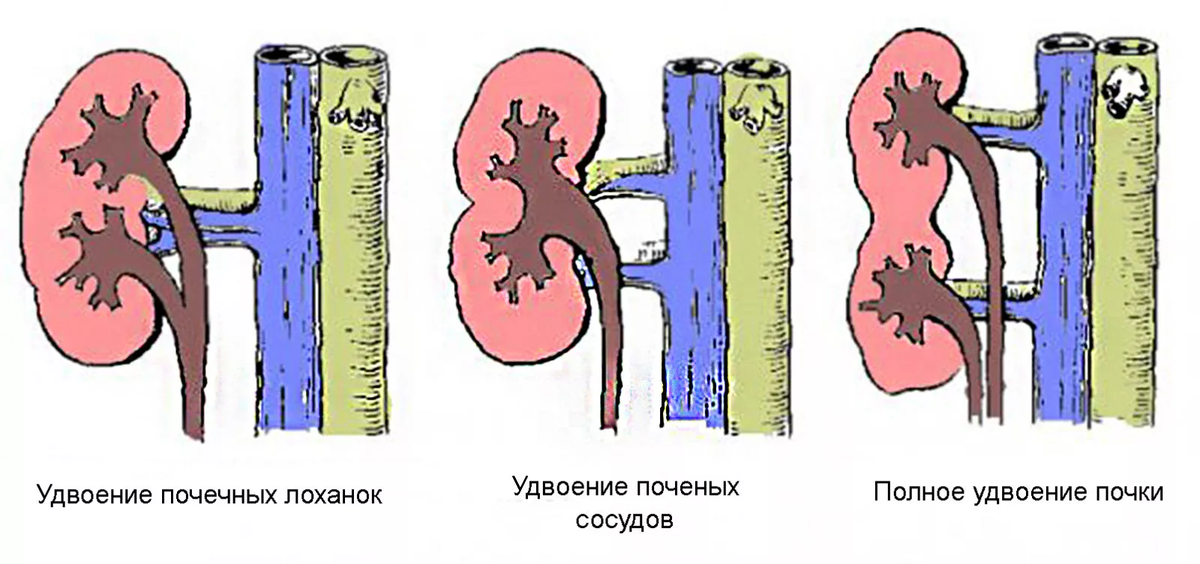 Почки по составу