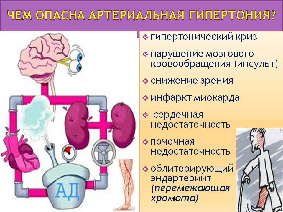 Гипертоническая болезнь в картинках