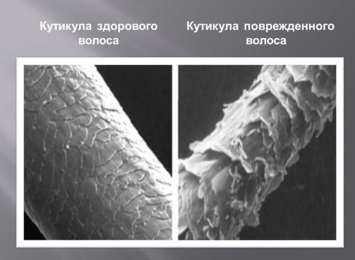 Как выглядит волос изнутри
