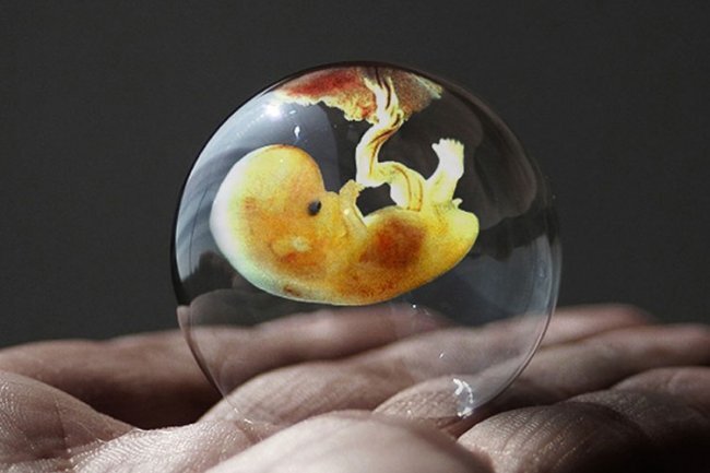 В ближайших планах исследователей – создание искусственного человеческого эмбриона. Если такое произойдет, то ученые получат уникальную возможность для экспериментальных исследований и редактирования генома. Но в случае с человеческими эмбрионами возникает огромная проблема – этика. Если получится искусственно создать эмбрион, можно ли над ним проводить эксперименты? Будет ли он отличаться от обычных людей? Но пока все эти вопросы отодвигаются на второй план.