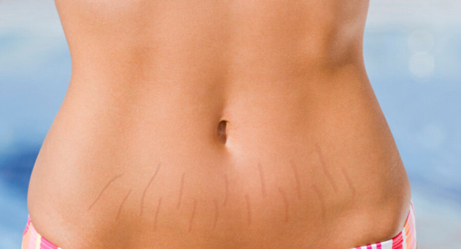 Уход за кожей