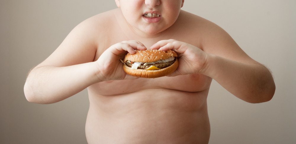 Про толстых детей. Ожирение у детей и подростков. Дети с СС ожирением.