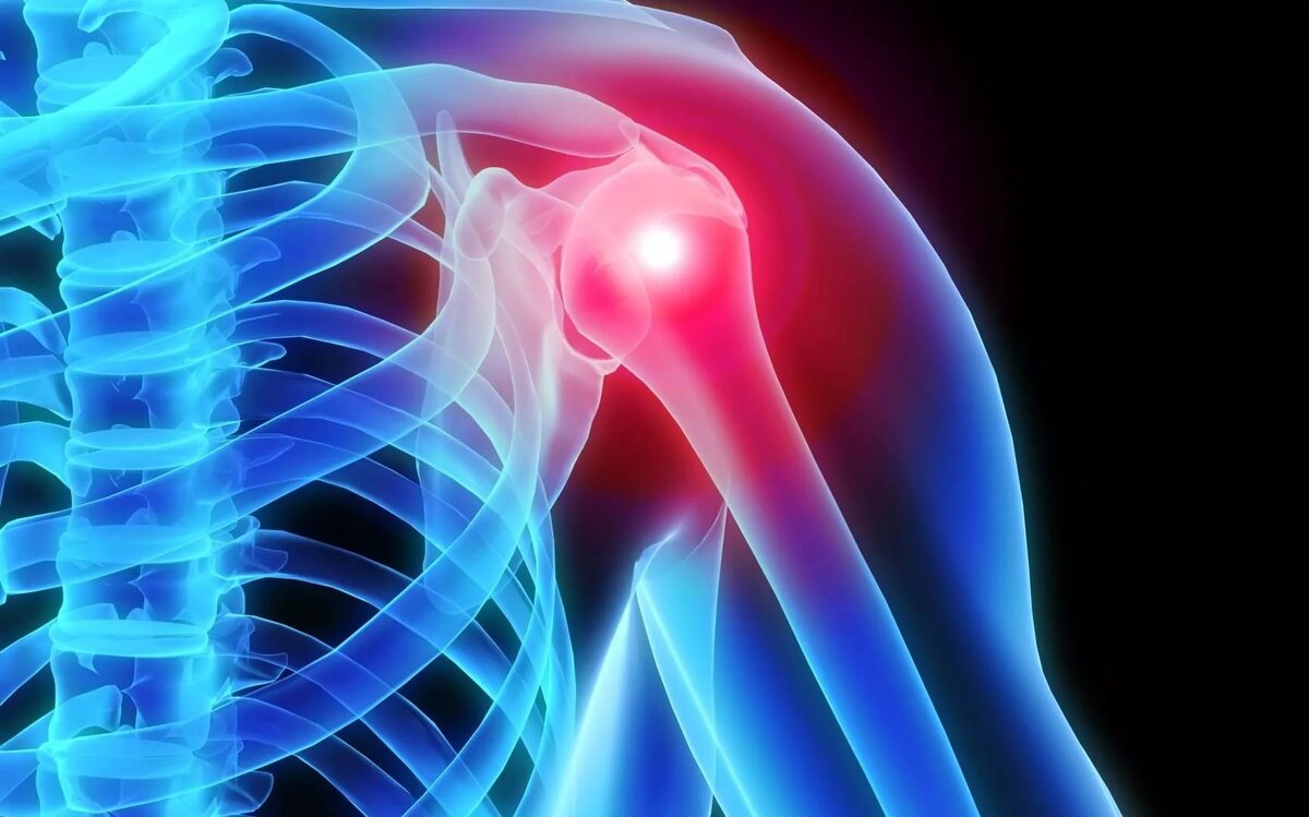 Источник фото - сайт medicina-portal.ru