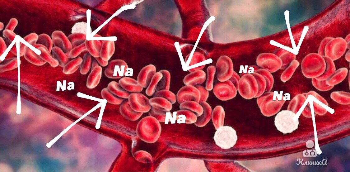 Просвет капилляра, заполненного натрием