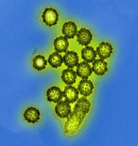 Просвечивающая электронная микрофотография вирусов гриппа A H1N1 (в цифровой форме)