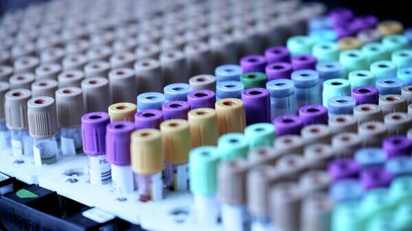   © Photo : Unsplash / Testalize.me