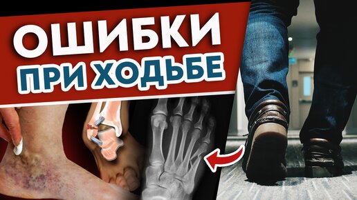 5 ошибок походки УБИВАЮТ организм! Срочно учимся правильно ХОДИТЬ!