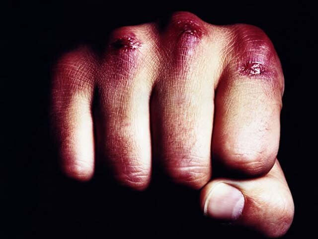 Как увеличить костяшки на кулаках: методы и рекомендации | boxingblog | Дзен