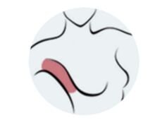     Уплотнения в подмышечной области 