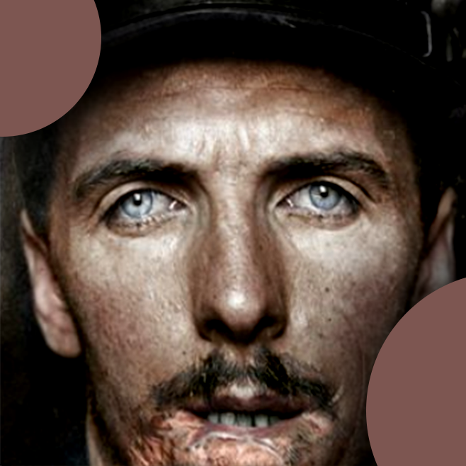 Французский солдат, чья челюсть была сломана выстрелом в упор, 1914 год.