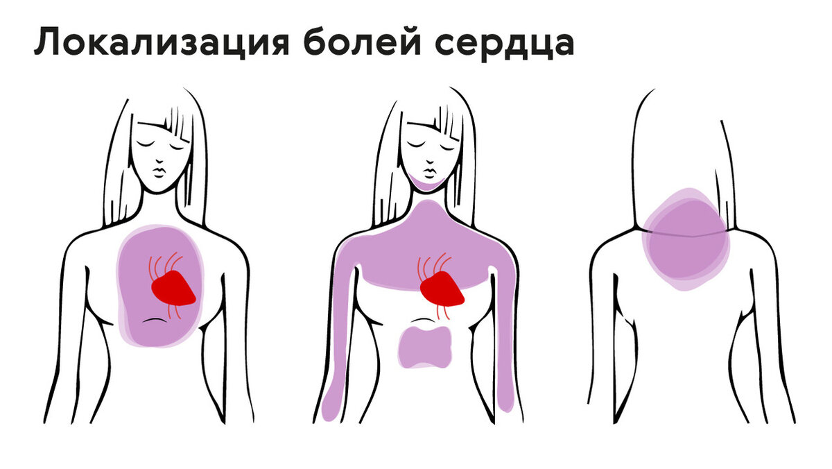 Жалобы человека при ишемической болезни сердца | Доктор Дарья Шандер | Дзен