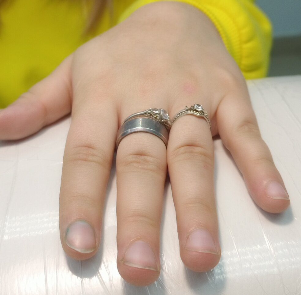 Руки модели "До"