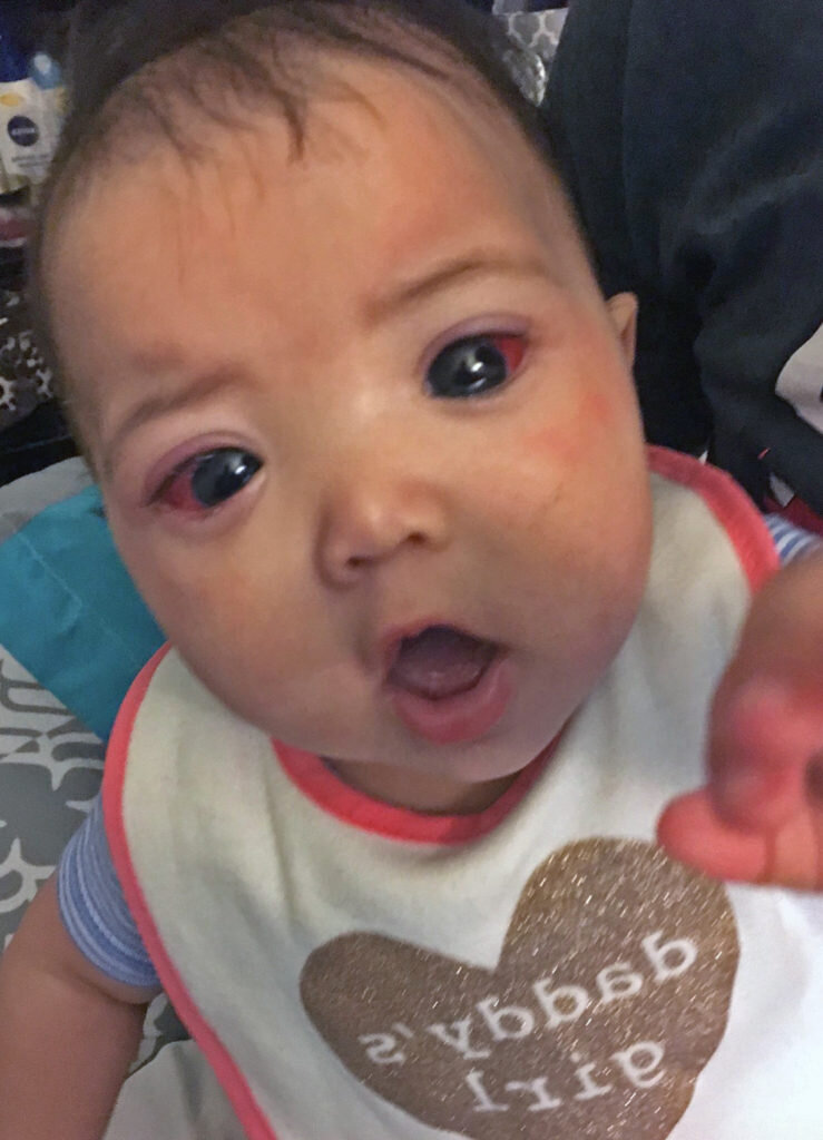 Малышка с огромными зрачками