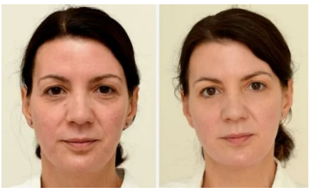 Картинка взята из открытых источников