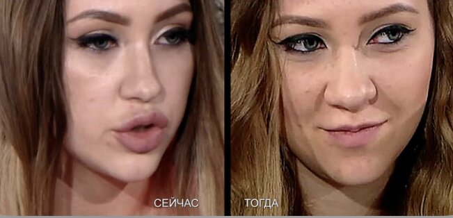 Фото Алёны «до и после»