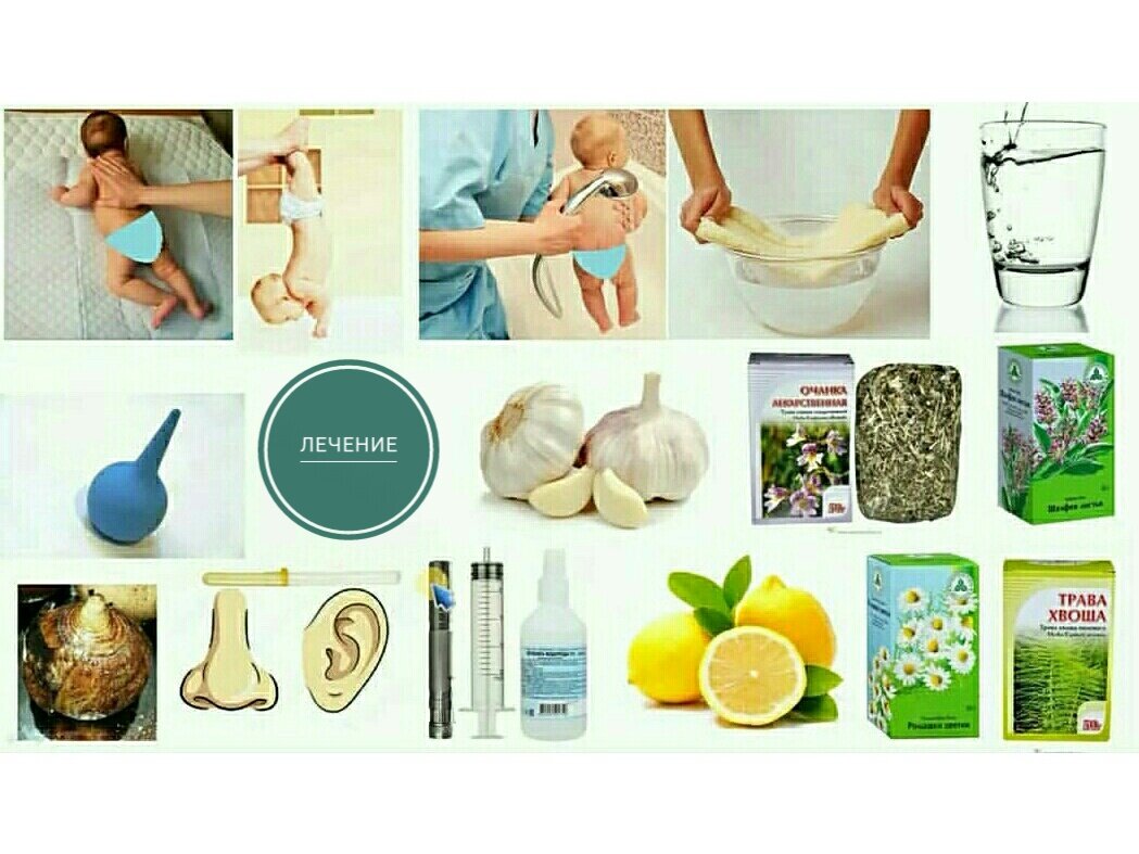 Есть простой эффективный алгоритм для лечения во время инфекций: растирание с разминкой, обливание, обильное питьё.