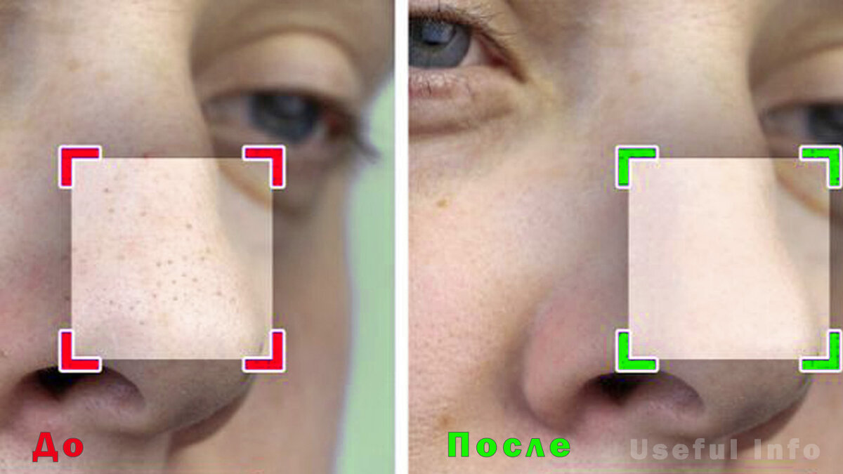До и после применения