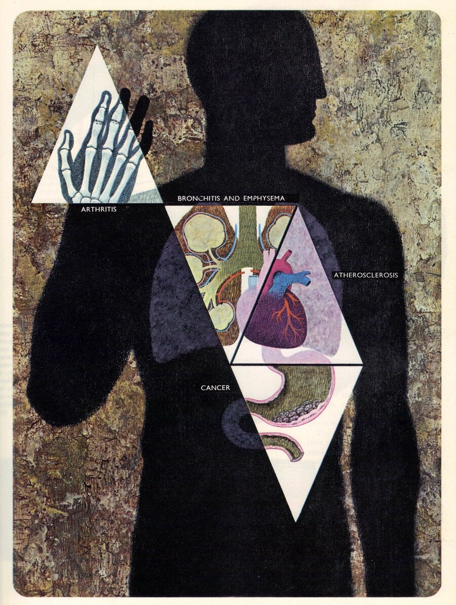 Illustration by Joseph Lombardero from Health and Disease, Time-Life International, 1965 / flickr.com/CC 0