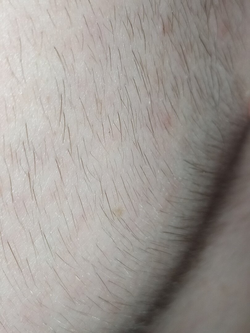 Первые волосы