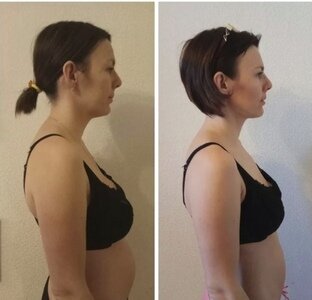 Обратите внимание, как изменившаяся осанка изменила в лучшую сторону контур нижней челюсти и подбородка. Фото: Яндекс Картинки