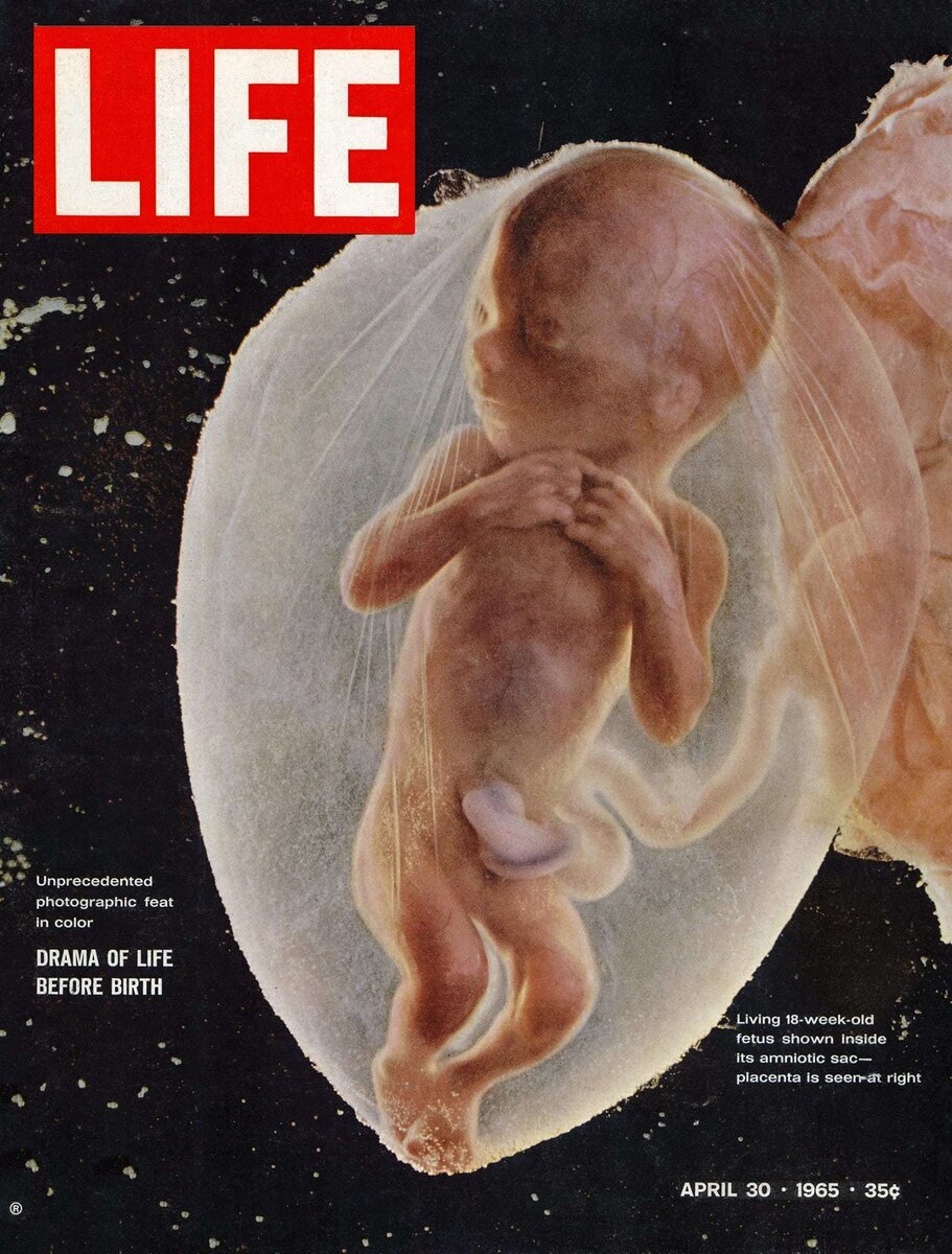 Обложка издания LIFE от 30 апреля 1965 года