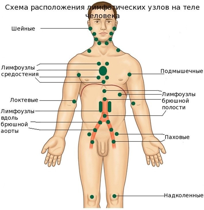 Внутрилегочные лимфоузлы на КТ