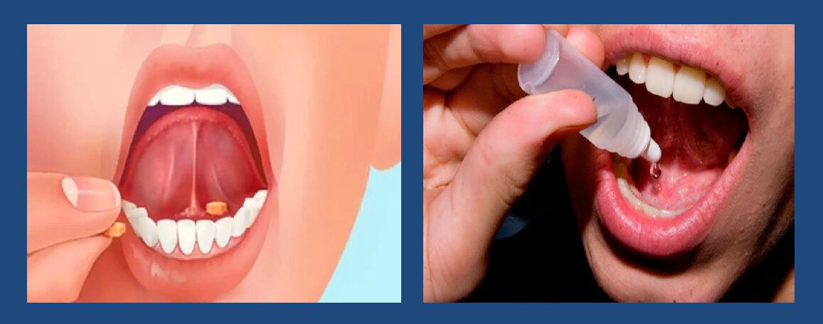 Например, приём препаратов под язык называется "сублингвальным" способом