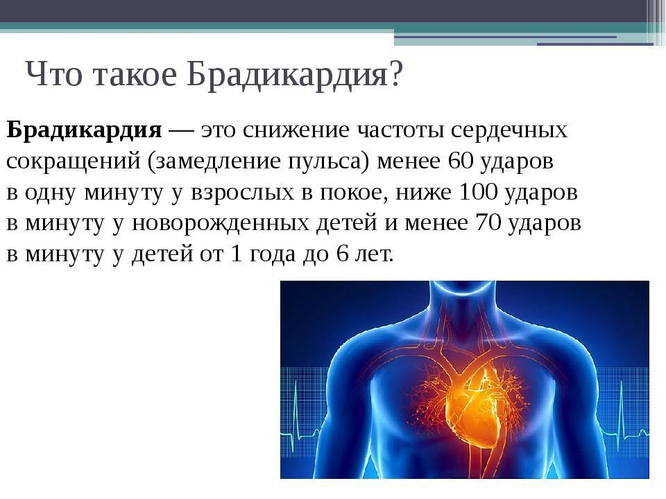 Брадикардия что это такое. Брадикардия. Бадигади. Брадикардия сердца что это. Брадикардия пульс.