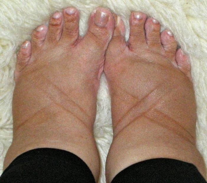 Фото взято из открытого источника 