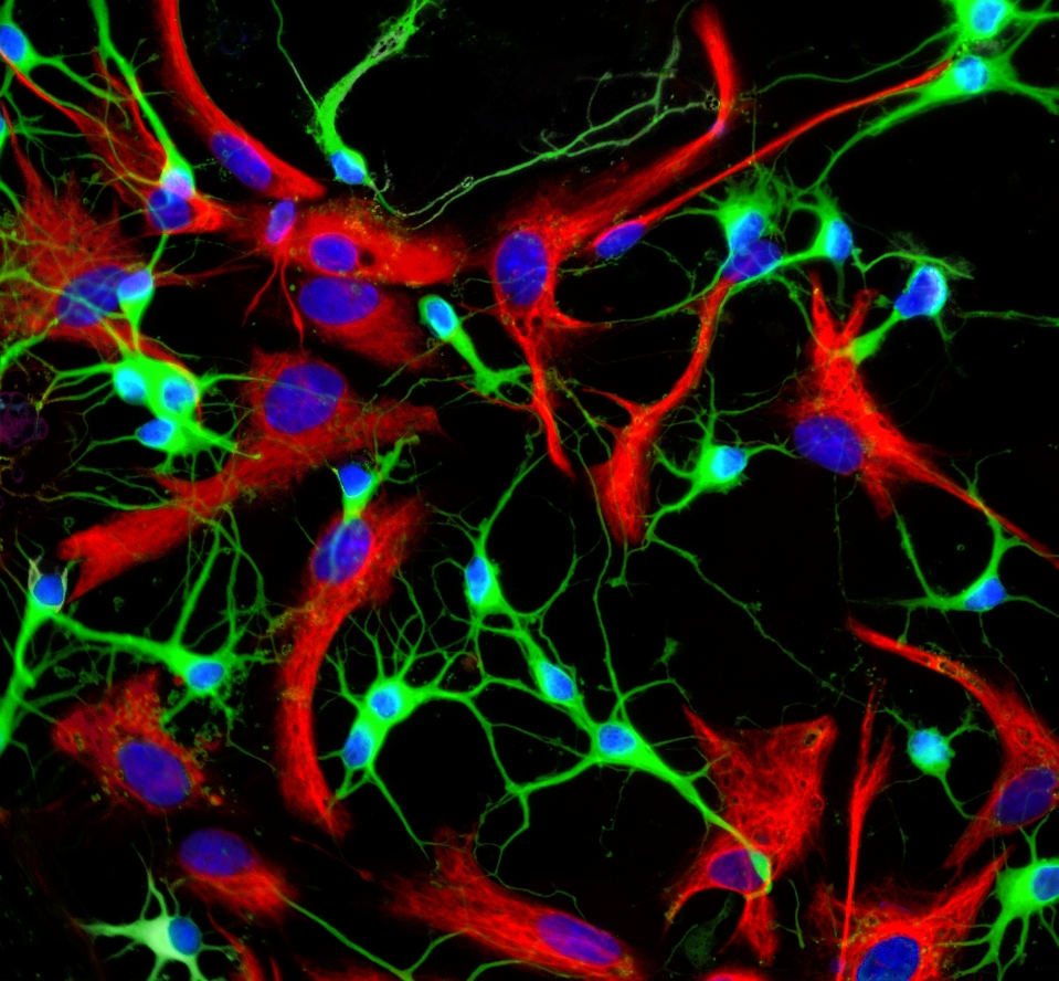 Астроциты мозга. GFAP астроциты. Астроциты головного мозга. Нейроны мозга. Красные Нейроны мозга.