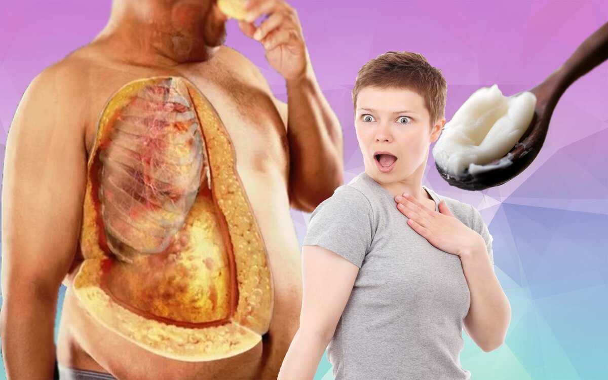 Висцеральный жир – угроза здоровью