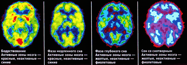 Активность мозга в разные моменты