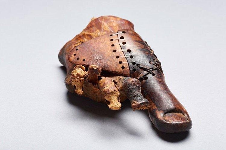 Первый протез большого пальца ноги. Фото из открытых источников.