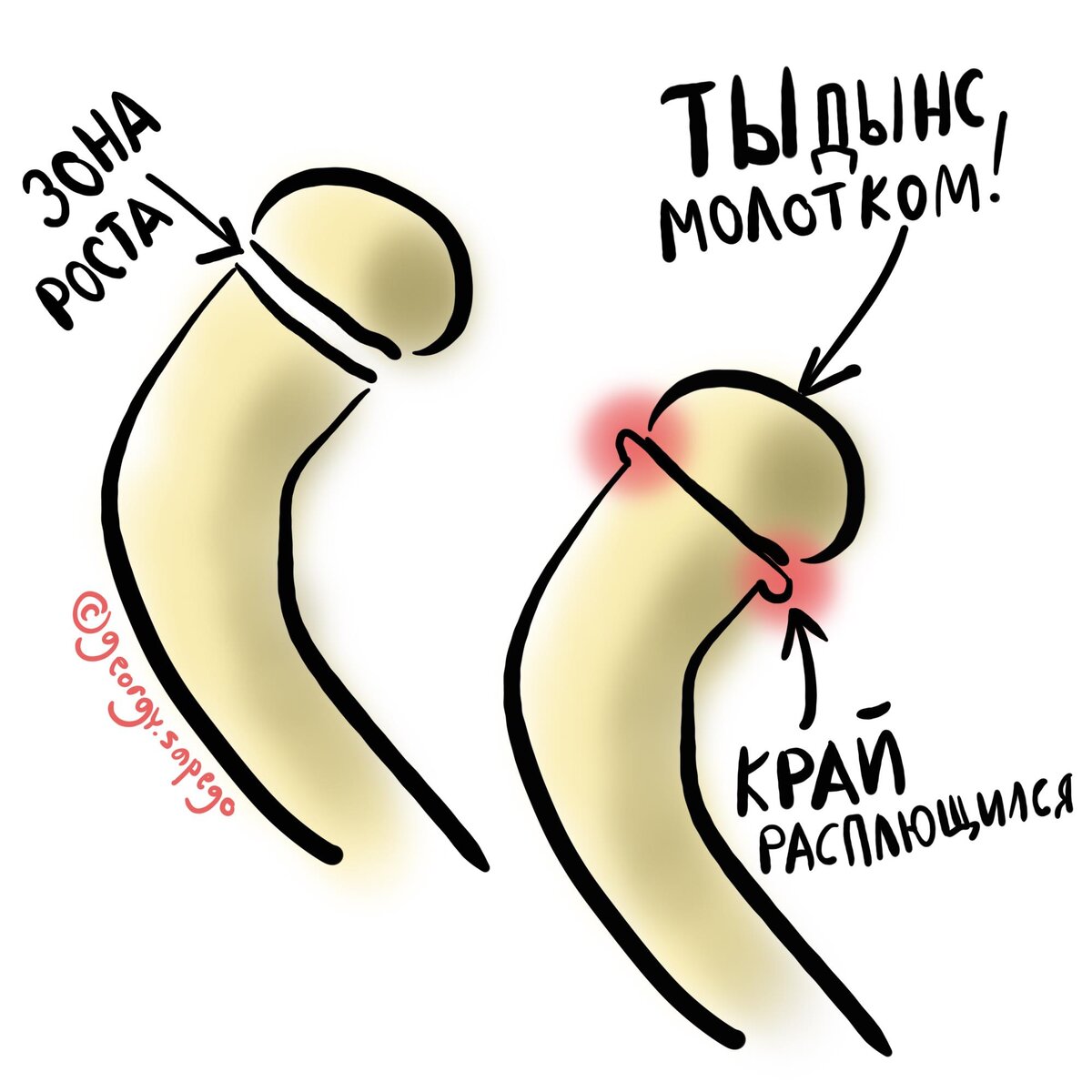 Польза шпагата для женского здоровья. Чем полезен шпагат для женского здоровья?