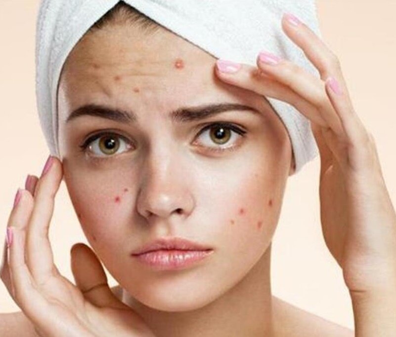 Яндекс.картинки